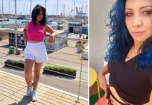 Estetik için Madrid’den İstanbul’da geldi, operasyondan sonra hayatını kaybetti!