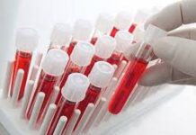 Araştırma/A Rh+ Kan Grubu olanlar kendini hep yorgun hissediyor. İşte sebebi ve çaresi…