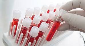 Araştırma/A Rh+ Kan Grubu olanlar kendini hep yorgun hissediyor. İşte sebebi ve çaresi…