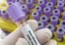 Hayvan teması olmadan ilk kuş gribi vakası saptandı.