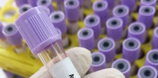 Hayvan teması olmadan ilk kuş gribi vakası saptandı.