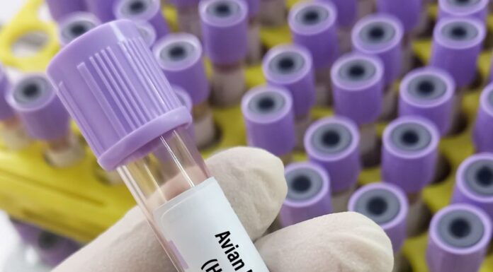 Hayvan teması olmadan ilk kuş gribi vakası saptandı.