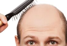 Kellikle sorunu olanlar, bu haber sizin için. İşte kelliğe yol açan vitamin eksiklikleri ve çözümleri