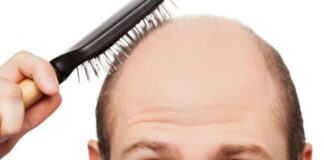 Kellikle sorunu olanlar, bu haber sizin için. İşte kelliğe yol açan vitamin eksiklikleri ve çözümleri