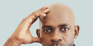 Saç dökülmesiyle mücadelede en son yöntemler.