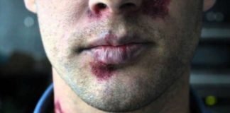 Uzmanlar Türkiye’de HIV virüsündeki artışa dikkat çektiler…’Bunların sadece yarısı HIV ile enfekte olduğunu biliyor’