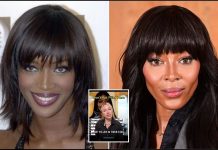 Estetik hekimi Molly Bailey:”Yüzünüze asla dolgu yaptırmayın. Uzaylı gibi görünmenize neden olur”