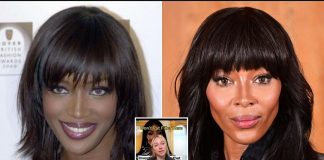 Estetik hekimi Molly Bailey:”Yüzünüze asla dolgu yaptırmayın. Uzaylı gibi görünmenize neden olur”