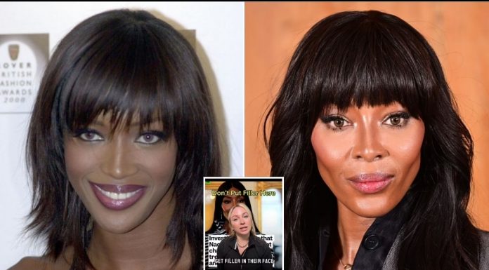 Estetik hekimi Molly Bailey:”Yüzünüze asla dolgu yaptırmayın. Uzaylı gibi görünmenize neden olur”