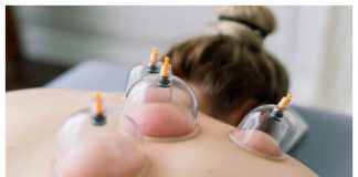 Aile hekimleri hacamat ve akupunktur gibi geleneksel hizmetleri de verecek .