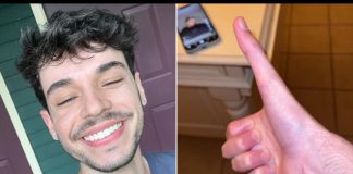 Yaklaşık 13 santimlik dünyanın en büyük baş parmağına sahip adam,en çok cep telefonu kullanırken zorluk çekiyor.