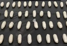 Tam 51 adet. Bu kapsüller bir kişinin bağırsağından çıktı!