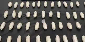 Tam 51 adet. Bu kapsüller bir kişinin bağırsağından çıktı!