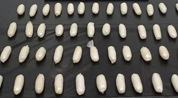 Tam 51 adet. Bu kapsüller bir kişinin bağırsağından çıktı!