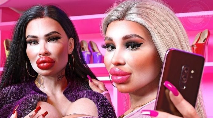 “Her şeyin büyük olmasını seviyorum” diyen Estetik bağımlısı kadın, bu hale geldi.