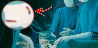 Tam 13 tane. 4 yaşındaki çocuğun midesinden çıkanlar şaşkına çevirdi