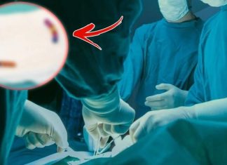 Tam 13 tane. 4 yaşındaki çocuğun midesinden çıkanlar şaşkına çevirdi