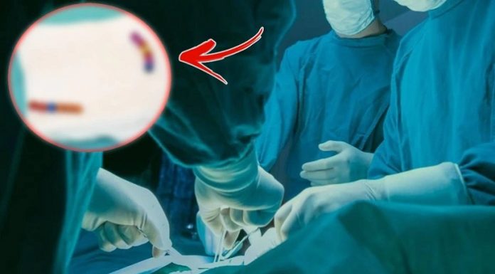 Tam 13 tane. 4 yaşındaki çocuğun midesinden çıkanlar şaşkına çevirdi