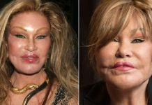 Servetini harcamıştı. Estetik bağımlısı ‘Kedi Kadın’ yaşamını yitirdi!