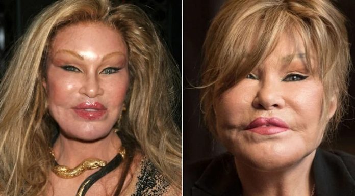 Servetini harcamıştı. Estetik bağımlısı ‘Kedi Kadın’ yaşamını yitirdi!