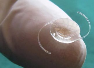 Hangi Göz İçi Lens En İyisidir?