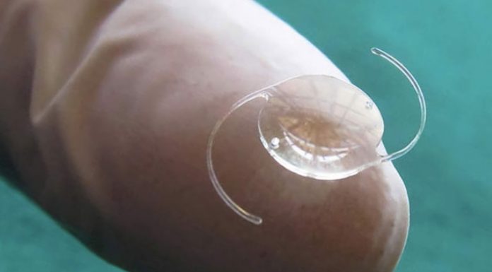 Hangi Göz İçi Lens En İyisidir?