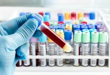 Kolon Kanseri, Kan Testi ile Doğru Biçimde Tespit Edilebilecek