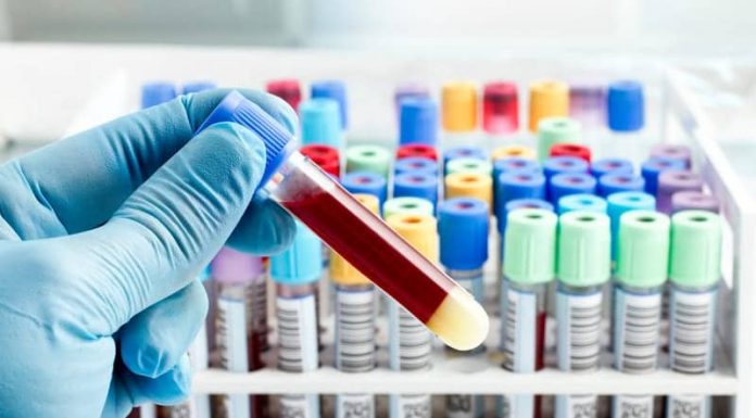 Kolon Kanseri, Kan Testi ile Doğru Biçimde Tespit Edilebilecek