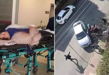 Kendisini bıçakla delik deşik eden kocasını savundu; ‘O benim çocuklarımın babası’