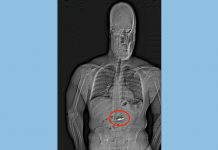 Hırsızlığın kanıtı!