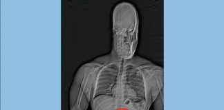 Hırsızlığın kanıtı!