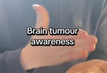 📽️ Bir doktor, gizli beyin tümörünüz olup olmadığını ortaya çıkarabilecek 30 saniyelik el testi öneriyor.