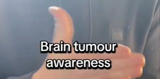 📽️ Bir doktor, gizli beyin tümörünüz olup olmadığını ortaya çıkarabilecek 30 saniyelik el testi öneriyor.