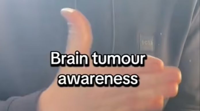 📽️ Bir doktor, gizli beyin tümörünüz olup olmadığını ortaya çıkarabilecek 30 saniyelik el testi öneriyor.