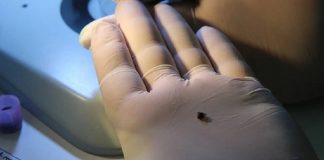 30’dan fazla hastalık taşıyor. İstilacı kene Türkiye’de ilk defa görüldü