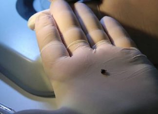 30’dan fazla hastalık taşıyor. İstilacı kene Türkiye’de ilk defa görüldü