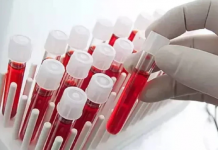 Resmen tanındı. Nur topu gibi yeni bir kan grubumuz oldu. Dünyada sadece 1 kişide görüldü