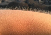 Araştırma/Tüylerin diken diken olmasının asıl sebebi…