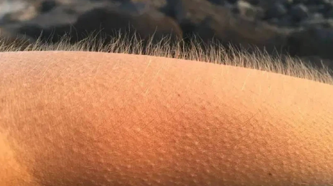 Tüylerin diken diken olması