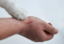 Kedi tırmığı her zaman masum değil!