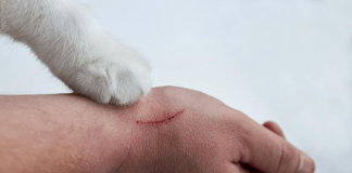Kedi tırmığı her zaman masum değil!