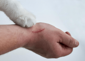 Kedi tırmığı her zaman masum değil!