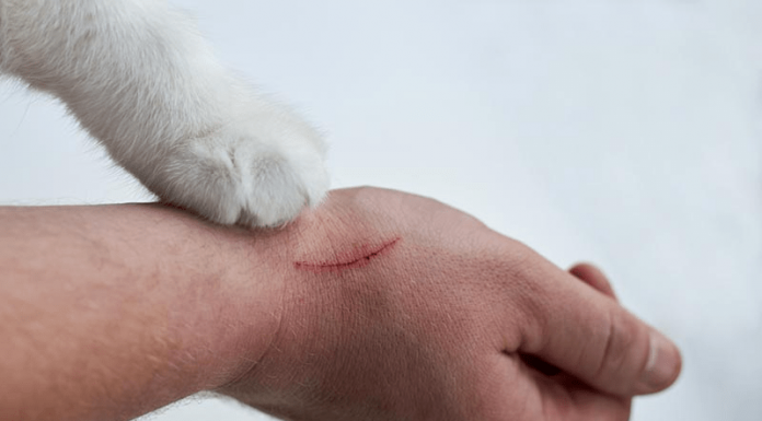 Kedi tırmığı her zaman masum değil!