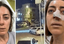 Yok böyle yanlışlık. Eşinin sevgilisi zannettiği kadını darp etti!