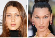 Almanya’da estetik ameliyatlarında ‘öncesi/sonrası fotoğrafları yayınlamak yasaklandı.