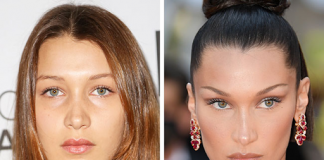 Almanya’da estetik ameliyatlarında ‘öncesi/sonrası fotoğrafları yayınlamak yasaklandı.