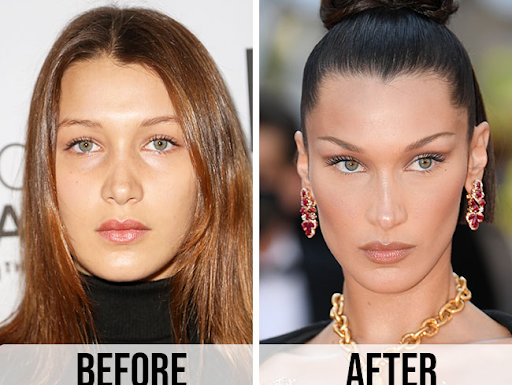 Almanya’da estetik ameliyatlarında ‘öncesi/sonrası fotoğrafları yayınlamak yasaklandı.