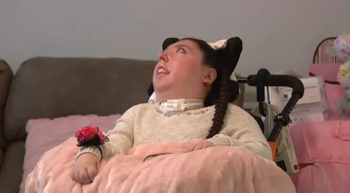 🎥Parmak büyüklüğünde beyinle doğmuştu; 20 yaşına girdi!