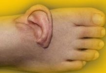 Benzeriz bir olay: Kulağını 5 ay ayağında taşıdı