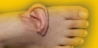 Benzeriz bir olay: Kulağını 5 ay ayağında taşıdı